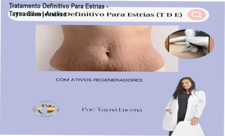 Representação visual do método de tratamento de estrias com foco em regeneração dérmica e ativos
