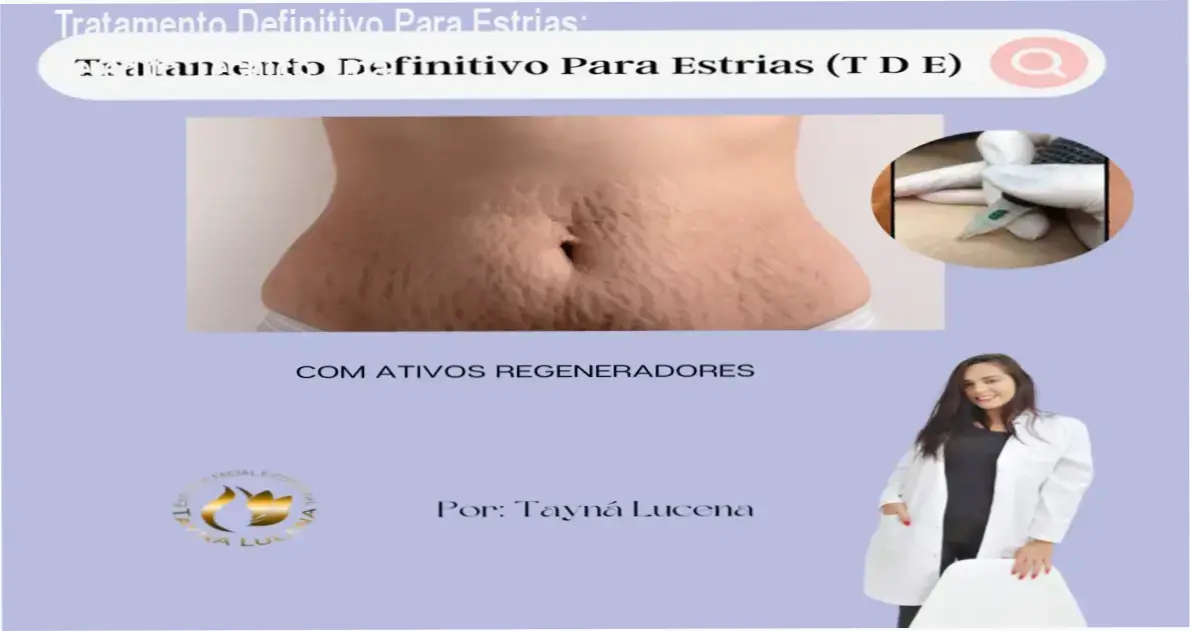 Demonstração da técnica de regeneração dérmica do método Tratamento Definitivo Para Estrias